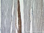 RBM24 Antibody in Immunohistochemistry (Paraffin) (IHC (P))