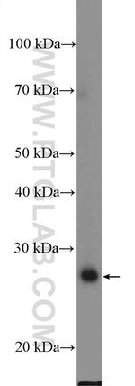 RBM24 Antibody in Western Blot (WB)