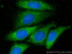 SLC28A3 Antibody in Immunocytochemistry (ICC/IF)