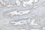 SLC28A3 Antibody in Immunohistochemistry (Paraffin) (IHC (P))