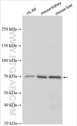 SLC28A3 Antibody in Western Blot (WB)