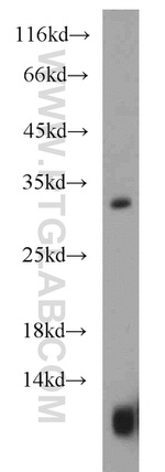 CST8 Antibody in Western Blot (WB)