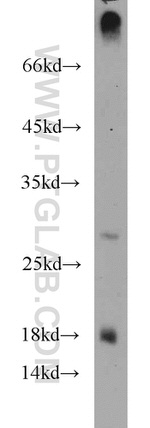 CST8 Antibody in Western Blot (WB)