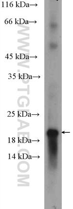 OMP Antibody in Western Blot (WB)