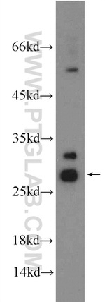 HIST1H1T Antibody in Western Blot (WB)