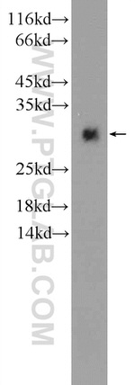HIST1H1T Antibody in Western Blot (WB)