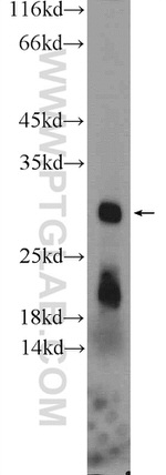 HIST1H1T Antibody in Western Blot (WB)
