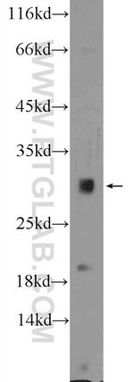 HIST1H1T Antibody in Western Blot (WB)