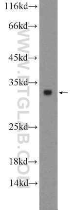 HIST1H1T Antibody in Western Blot (WB)