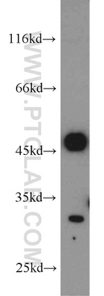 Mast Cell Chymase Antibody in Western Blot (WB)