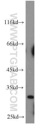 Mast Cell Chymase Antibody in Western Blot (WB)