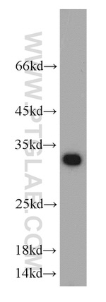 Mast Cell Chymase Antibody in Western Blot (WB)