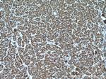 LACTB Antibody in Immunohistochemistry (Paraffin) (IHC (P))