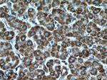 LACTB Antibody in Immunohistochemistry (Paraffin) (IHC (P))