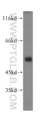 LACTB Antibody in Western Blot (WB)