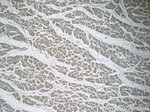 PPM1L Antibody in Immunohistochemistry (Paraffin) (IHC (P))