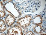PPM1L Antibody in Immunohistochemistry (Paraffin) (IHC (P))
