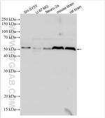 CBLN1 Antibody in Western Blot (WB)