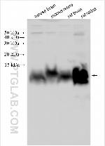 DYSFIP1 Antibody in Western Blot (WB)