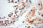 RPS9 Antibody in Immunohistochemistry (Paraffin) (IHC (P))