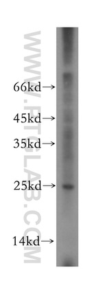 RPS9 Antibody in Western Blot (WB)