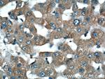 LSR Antibody in Immunohistochemistry (Paraffin) (IHC (P))