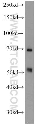 LSR Antibody in Western Blot (WB)