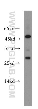 UBE2S Antibody in Western Blot (WB)