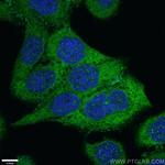 IkB alpha Antibody in Immunocytochemistry (ICC/IF)