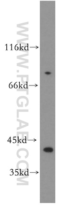 IkB alpha Antibody in Western Blot (WB)