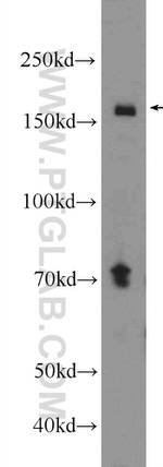 NFATC3 Antibody in Western Blot (WB)