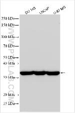 DOHH Antibody in Western Blot (WB)