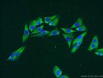 RPS8 Antibody in Immunocytochemistry (ICC/IF)