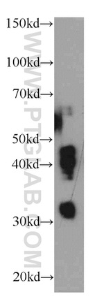 HUS1B Antibody in Western Blot (WB)