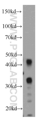 HUS1B Antibody in Western Blot (WB)