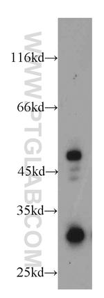 HUS1B Antibody in Western Blot (WB)