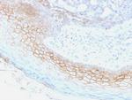 Desmocollin-2/3 Monoclonal Antibody (7G6)