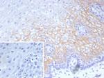 Desmocollin-2/3 Recombinant Mouse Monoclonal Antibody (DSC2/9165R)
