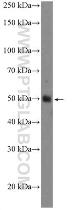 TXNIP Antibody in Western Blot (WB)