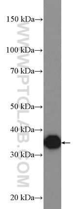 AKR1B10 Antibody in Western Blot (WB)