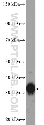 AKR1B10 Antibody in Western Blot (WB)
