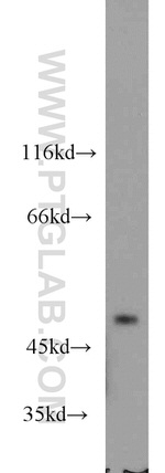 CHN2 Antibody in Western Blot (WB)
