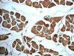 PDK1 Antibody in Immunohistochemistry (Paraffin) (IHC (P))