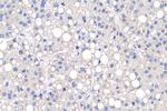 PDK1 Antibody in Immunohistochemistry (Paraffin) (IHC (P))