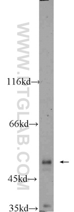 PDK1 Antibody in Western Blot (WB)
