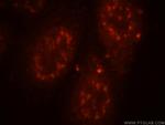 Pinin Antibody in Immunocytochemistry (ICC/IF)