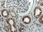ATP6V0D1 Antibody in Immunohistochemistry (Paraffin) (IHC (P))