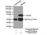 Fukutin Antibody in Immunoprecipitation (IP)