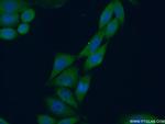 STRAP Antibody in Immunocytochemistry (ICC/IF)