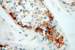STRAP Antibody in Immunohistochemistry (Paraffin) (IHC (P))